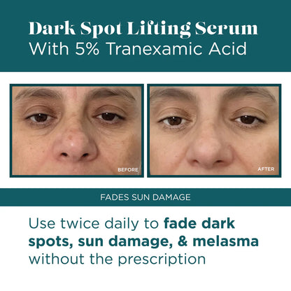 Dark Spot Lifting Serum with Number 5% Tranexamic Acid